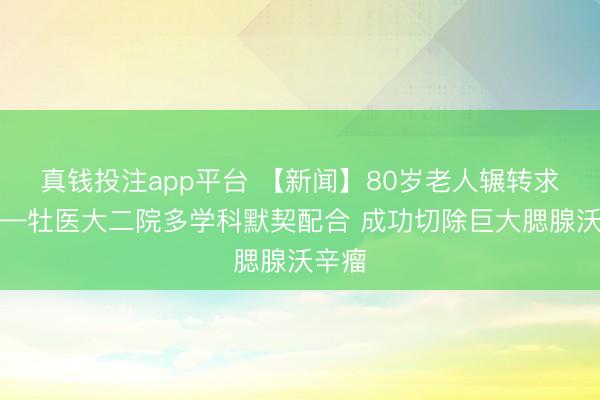 真钱投注app平台 【新闻】80岁老人辗转求医——牡医大二院多学科默契配合 成功切除巨大腮腺沃辛瘤