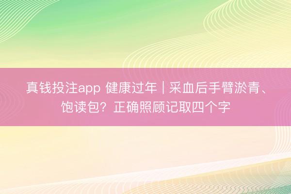 真钱投注app 健康过年 | 采血后手臂淤青、饱读包？正确照顾记取四个字